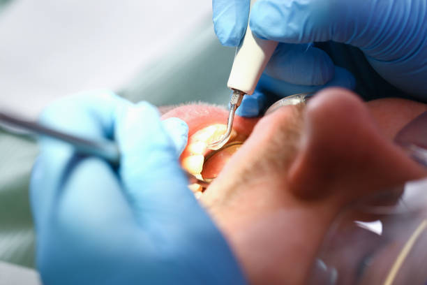 Best Emergency Broken Tooth Repair in Searingtown, NY