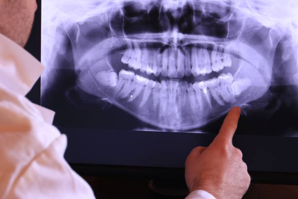 Best Walk-In Emergency Dentist in Searingtown, NY
