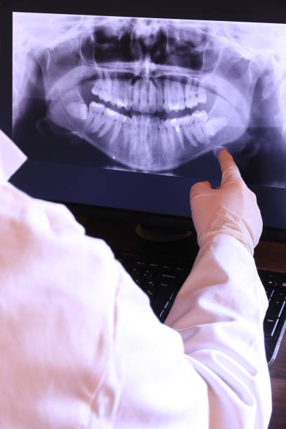Best Emergency Wisdom Teeth Removal in Searingtown, NY